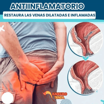 DICTAMNI - ALIVIO INMEDIATO gel anti-hemorroides