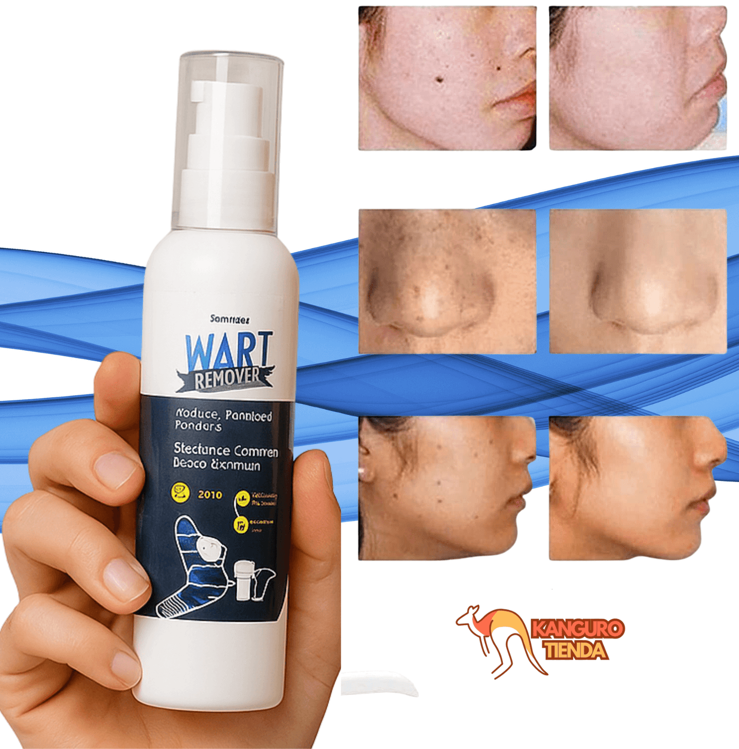 Spray Removedor - Adiós Verrugas - Confianza en Pocos Días