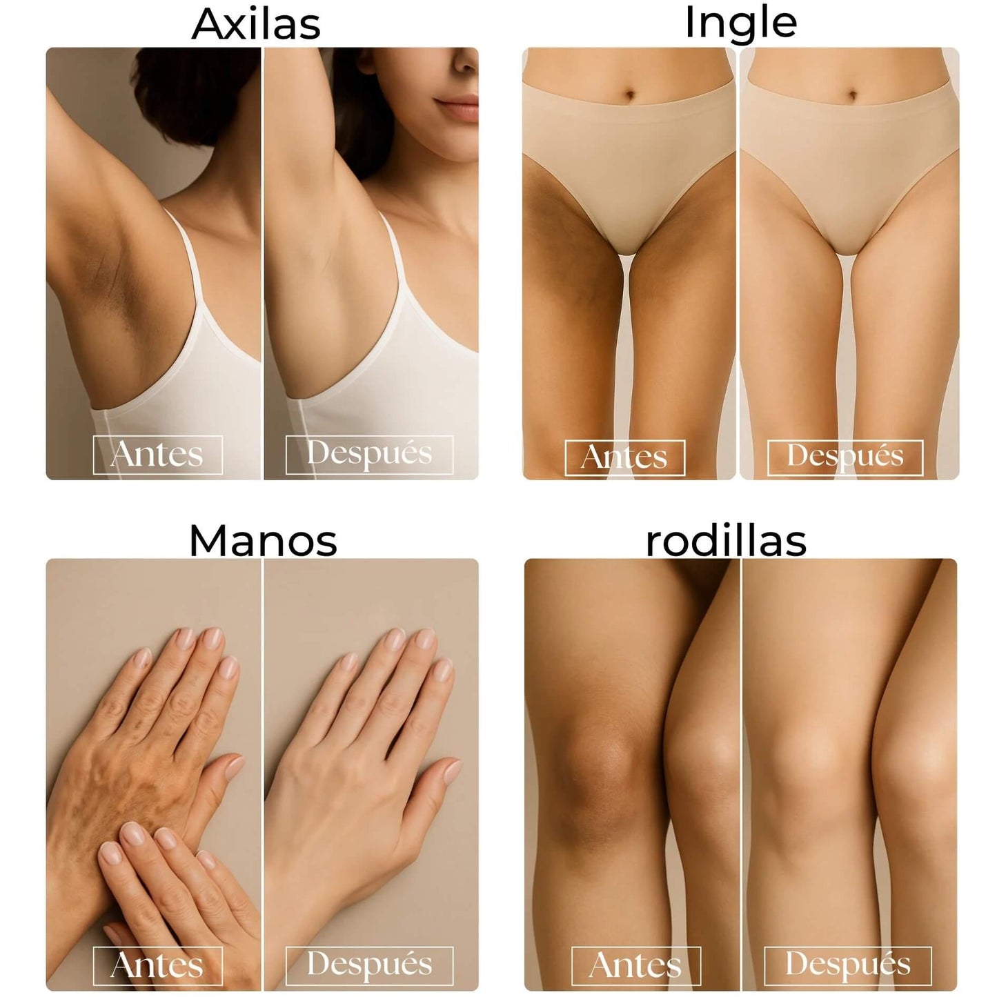 Crema Blanqueadora – Piel más uniforme en 7 días